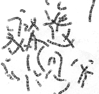 karyotype analysis software free