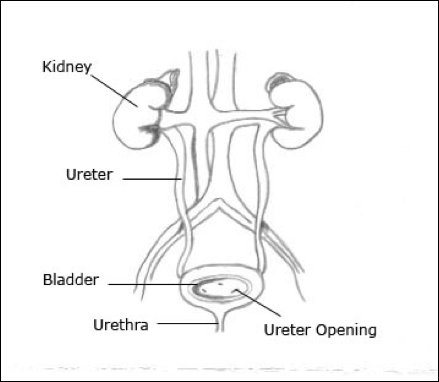 posterior urethral valves diagram